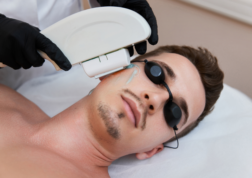 plasma skin tag removal