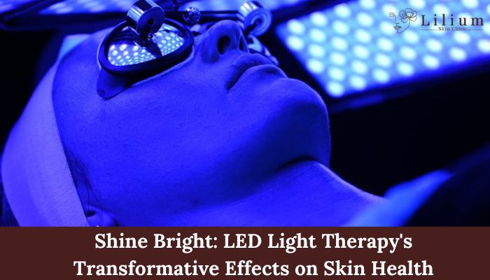 LED light therapy