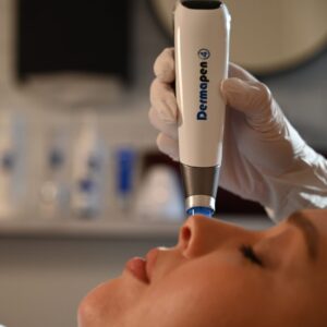 Skin-needling